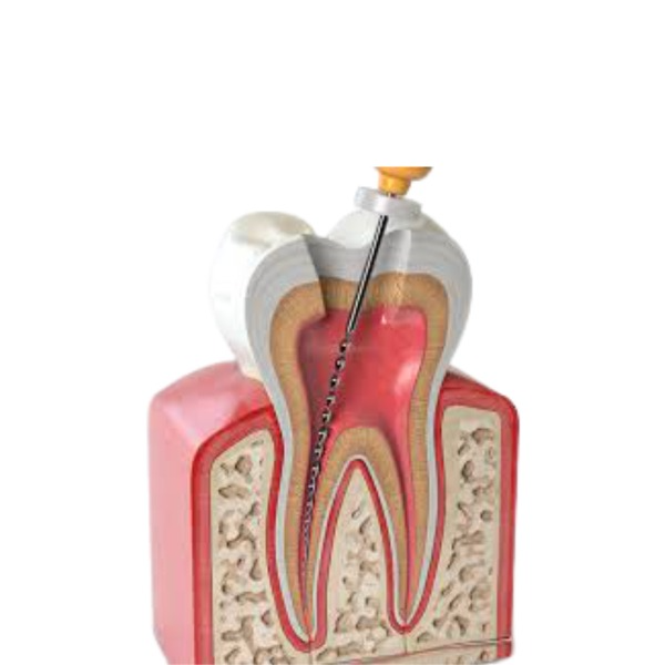 Endodontics