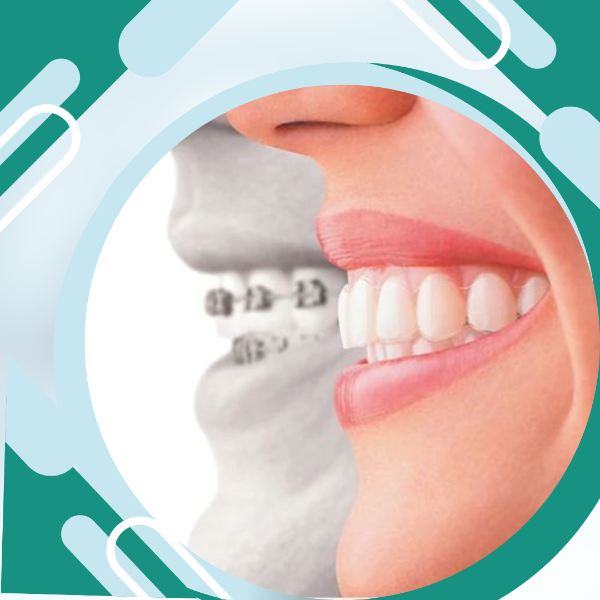 Orthodontic treatment