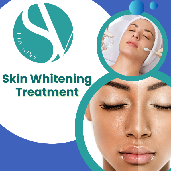 Best Dermatologist in Kothamangalam Skinvue Clinic