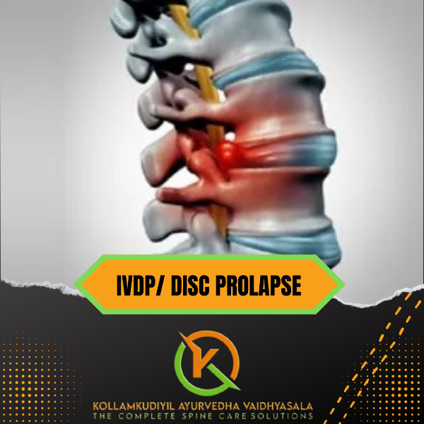 IVDP/ DISC PROLAPSE TREATMENT