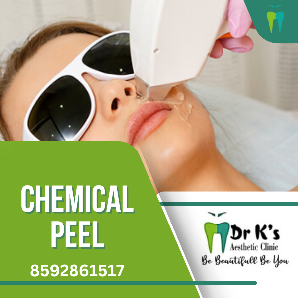 Chemical Peel