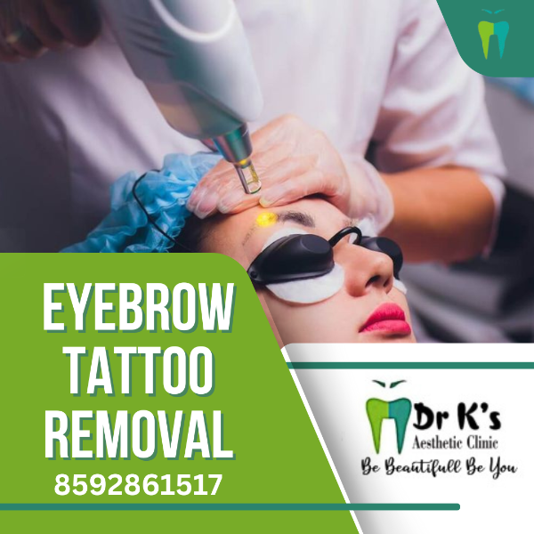 Eyebrow Tattoo Removal