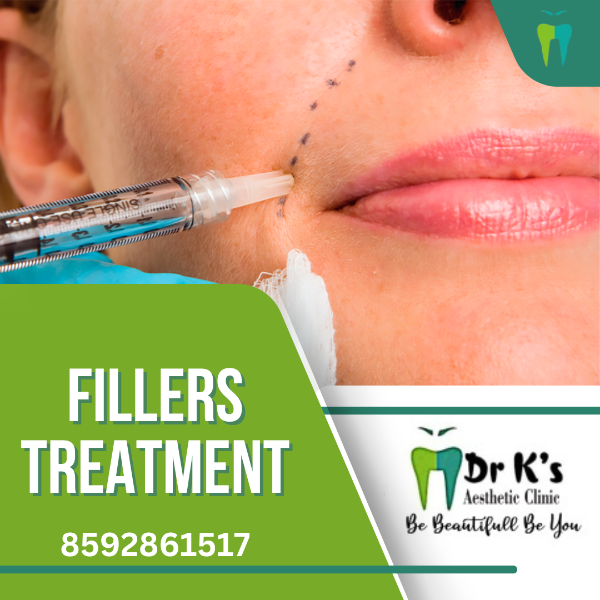 Fillers Treatment