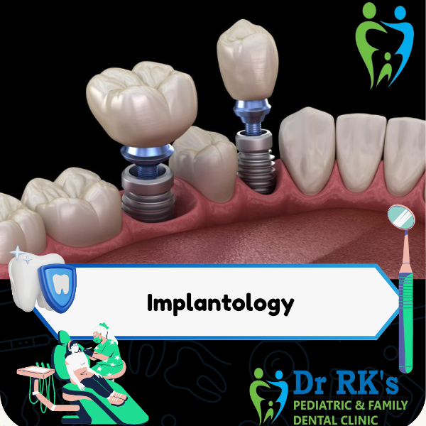 Implantology