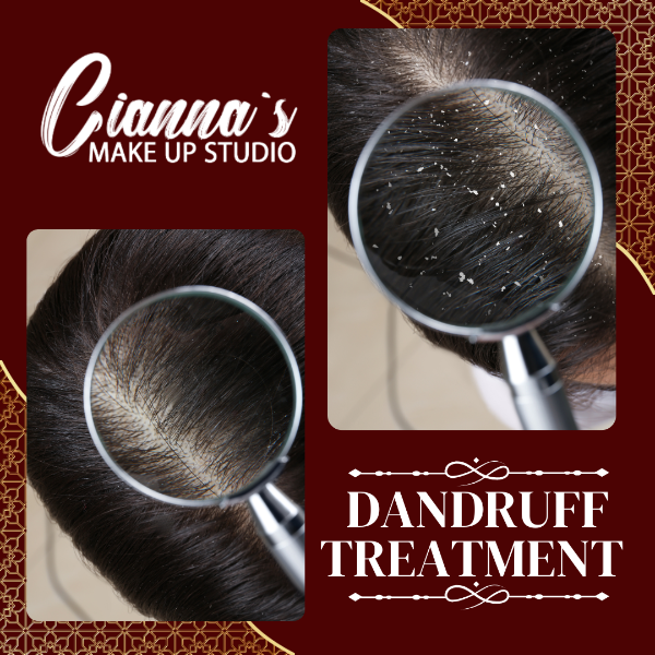 DANDRUFF TREATMENT