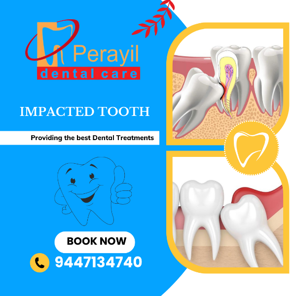 impacted tooth